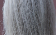 4 dấu hiệu kỳ lạ ở da, tóc cảnh báo cơ thể thiếu vitamin
