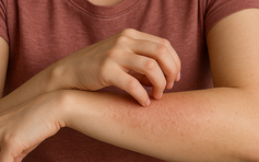 4 dấu hiệu thận yếu dễ bị bỏ qua ở người dưới 30 tuổi