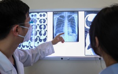 Ô xy y tế là thuốc thiết yếu không có dược phẩm thay thế