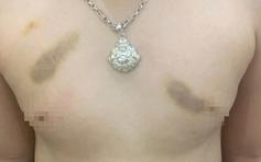 Phụ huynh tố giáo viên bạo hành trẻ, yêu cầu bồi thường 1 năm học phí