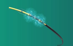 Ứng dụng công nghệ phá vôi lòng mạch mới điều trị hẹp mạch vành phức tạp