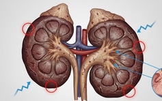 Tổn thương thận: Lần đầu tiên khoa học tìm ra cách đảo ngược bệnh!