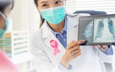 Alo bác sĩ nghe: Có phải còn trẻ thì không mắc ung thư vú?