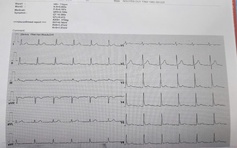 'Xuất viện rồi, không biết bệnh nhân suy tim đi đâu, về đâu?'