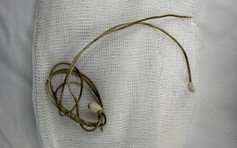 Cứu nam sinh nhét dây sạc điện thoại vào niệu đạo để tạo 'cảm giác lạ'