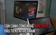 Cận cảnh công nghệ phát hiện xơ vữa, đánh giá nguy cơ nhồi máu cơ tim đầu tiên tại VN