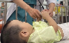 RSV khiến hơn 3 triệu ca nhập viện và gần 60.000 trẻ em tử vong mỗi năm