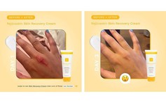 Hướng dẫn sử dụng kem phục hồi Rejuvaskin đúng chuẩn chuyên gia đạt hiệu quả tối đa