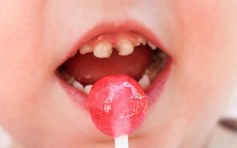 Tầm quan trọng của răng sữa, điều ít mẹ biết