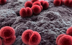 Số ca nhiễm não mô cầu tăng: Bệnh lây lan qua những con đường nào?