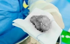 Đau nhiều ngày ở vùng bìu, đến bệnh viện khám phát hiện tinh hoàn hoại tử