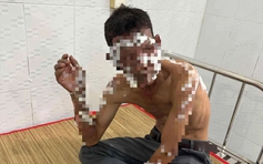 Nổ bình gas mini trong đám giỗ, 8 người nhập viện