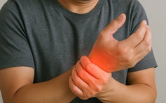 Alo bác sĩ nghe: Viêm khớp dạng thấp có thể chữa khỏi hoàn toàn?