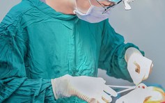 Tạo hình mũi cho người châu Á: Hiểu đúng đặc trưng và giải pháp cá nhân hóa