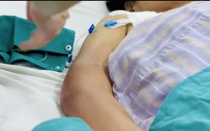 Rơi vào nguy kịch do một thủ thuật không đảm bảo vô trùng