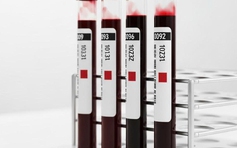 Đột phá: Sắp có máu nhân tạo, truyền được cho tất cả mọi người!