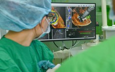 Ứng dụng 'GPS nha khoa' X-Guide: Bước tiến mới trong cấy ghép Implant