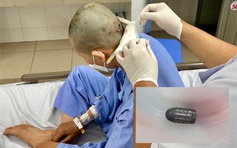 Công an làm rõ vụ người phụ nữ bị trúng đạn vào đầu khi đang làm vườn