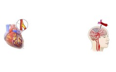 Nhận biết dấu hiệu có thể gây tử vong tức thời