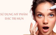 Cách sử dụng kem trị mụn hiệu quả, ngăn ngừa tái phát