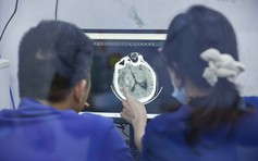 Báo động gia tăng đột quỵ