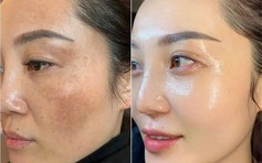 Top 3 Retinol cứ bôi da bật chế độ tươi trẻ, tuổi tác chỉ là con số