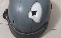 TP.HCM: Nam thanh niên bị người đàn ông tấn công 'vô cớ' trên đường phải nhập viện