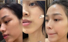 Top 5 Retinol ‘sửa nếp nhăn’, mờ đốm nâu da trẻ hóa, nguyện mua đi mua lại