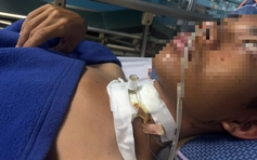 Thoát chết hy hữu sau khi bị sợi dây cứa đứt khí quản giữa đường