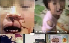 Hưng Yên: Bị khởi tố vì đánh đập, cấm con đi học