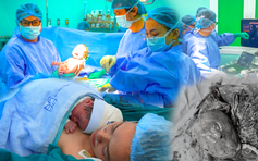Ca can thiệp bào thai cực hiếm, cứu thai nhi mắc khối u nhau thai khổng lồ
