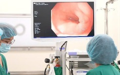 Trẻ em có nội soi tiêu hóa được không?