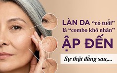 Làn da có tuổi là ‘combo’ khô nhăn ập đến: Sự thật phũ phàng đằng sau!