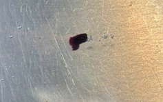 Hy hữu: Mảnh kim loại bắn xuyên tinh hoàn nam thanh niên khi đang làm việc