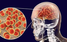 Cà Mau ghi nhận 3 ca nghi viêm não mô cầu, 1 trường hợp tử vong