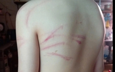 Đình chỉ cơ sở dạy thêm sau phản ánh giáo viên đánh học sinh lớp 7