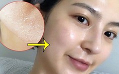 Top 6 sữa rửa mặt cho da khô ráp, nứt nẻ cũng trở nên mềm mịn