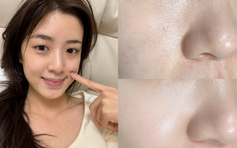 Tưởng filter, ai ngờ U40 trẻ như 20 nhờ 3 kem trắng da chống lão hóa này!