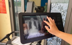Hà Nội khám sàng lọc miễn phí 12 bệnh mạn tính, ác tính