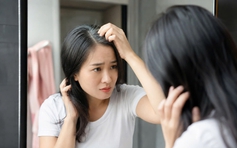 Tóc bạc trước tuổi 35: Những nguyên nhân ít ai ngờ