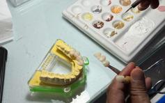 Làm sao biết được chất lượng thật của răng giả?