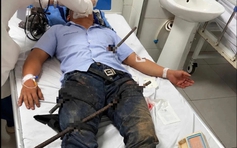 Bị 2 thanh sắt đâm xuyên từ đùi lên bụng, người đàn ông được cứu sống