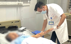 Cẩn trọng khi nhà có chó nuôi con