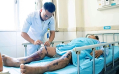 Sau hành trình sinh tử trên biển, 3 ngư dân tiếp tục điều trị tại bệnh viện