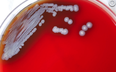 Lần đầu phát hiện 'vi khuẩn ăn thịt người' trong mẫu đất và nước tại Mỹ
