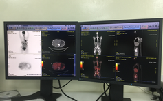 Bệnh viện thứ 3 tại TP.HCM có máy PET/CT chẩn đoán, điều trị ung thư