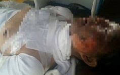 Bị người tình tưới xăng châm lửa đốt, một phụ nữ tử vong