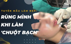 Nở rộ hội nhóm tuyển mẫu làm đẹp: Rùng mình khi khách là 'chuột bạch’