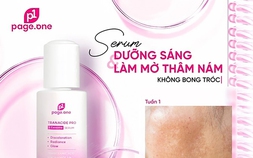 Cứ 30 giây lại có 1 chai bán ra, serum trị nám xứ Hàn phải thế chứ!