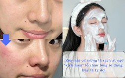 Rửa mặt cứ tưởng là sạch ai ngờ ‘kích hoạt’ lỗ chân lông to đùng!